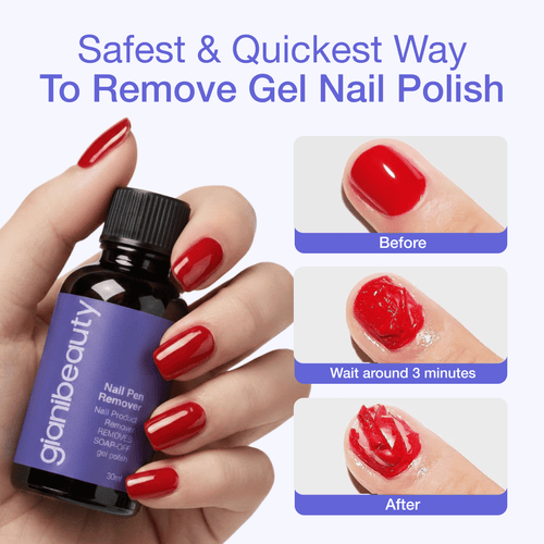 Removal Essentials Kit